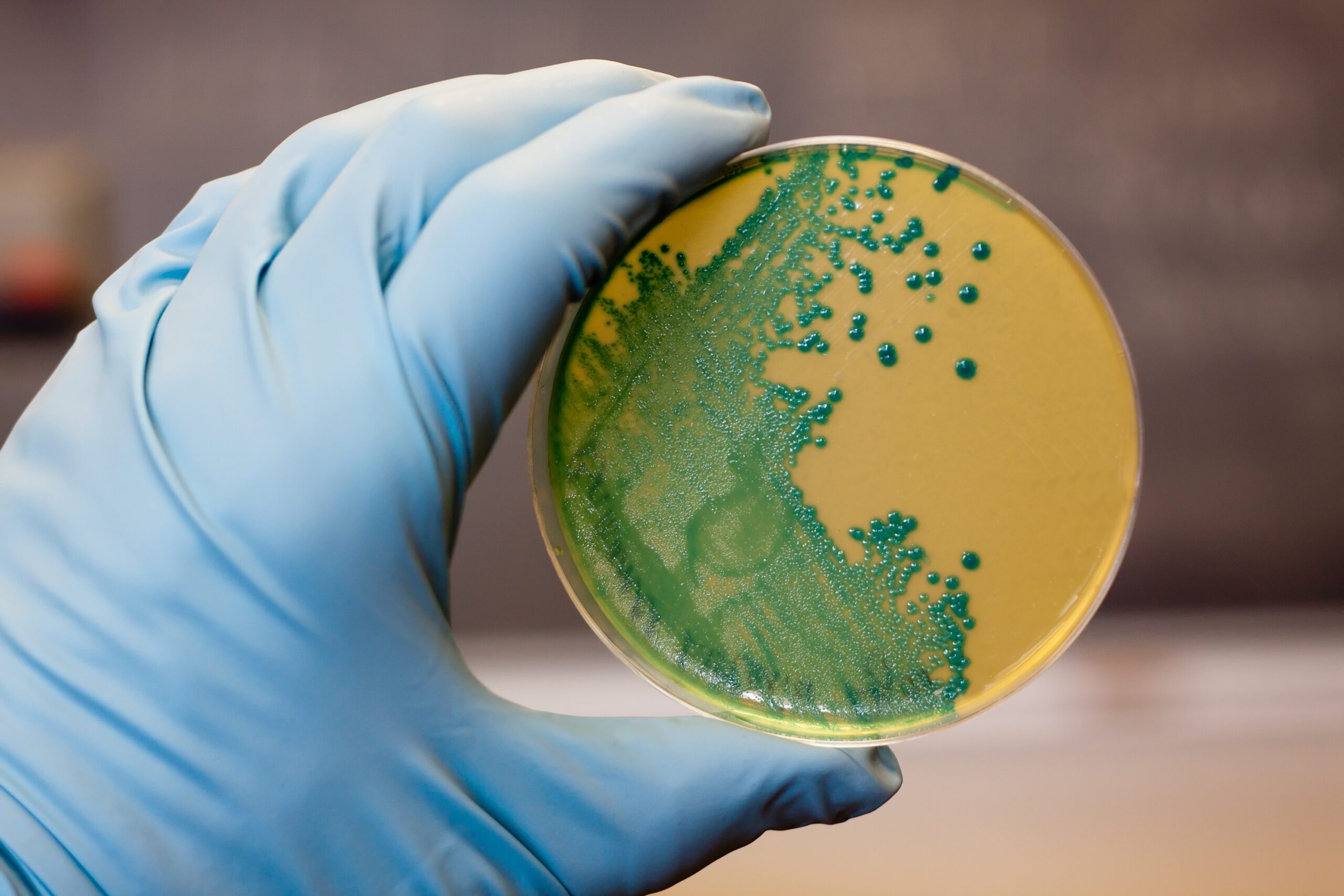 Listeria bacteria on agar plate
